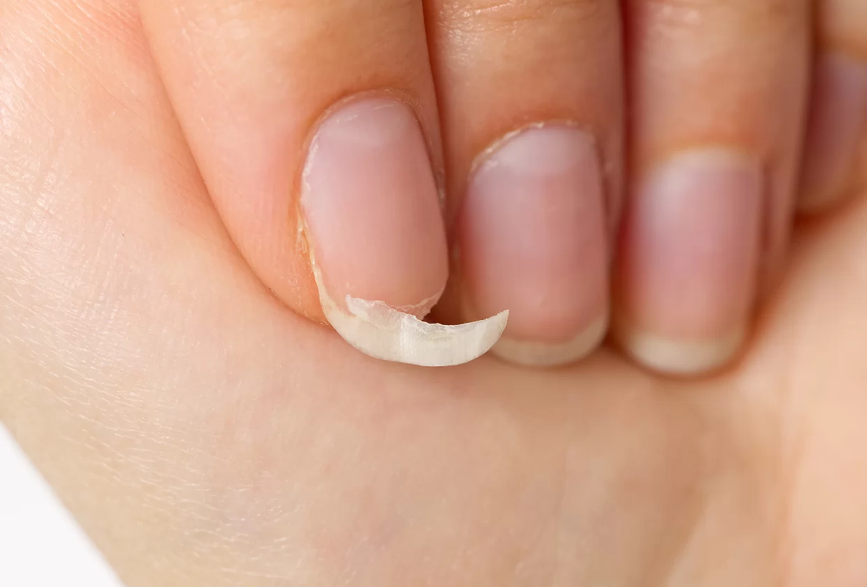 Tipos de Unhas: descubra o formato perfeito para você! 31 cuidados com as unhas