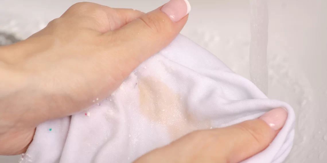 Como tirar manchas de roupa branca