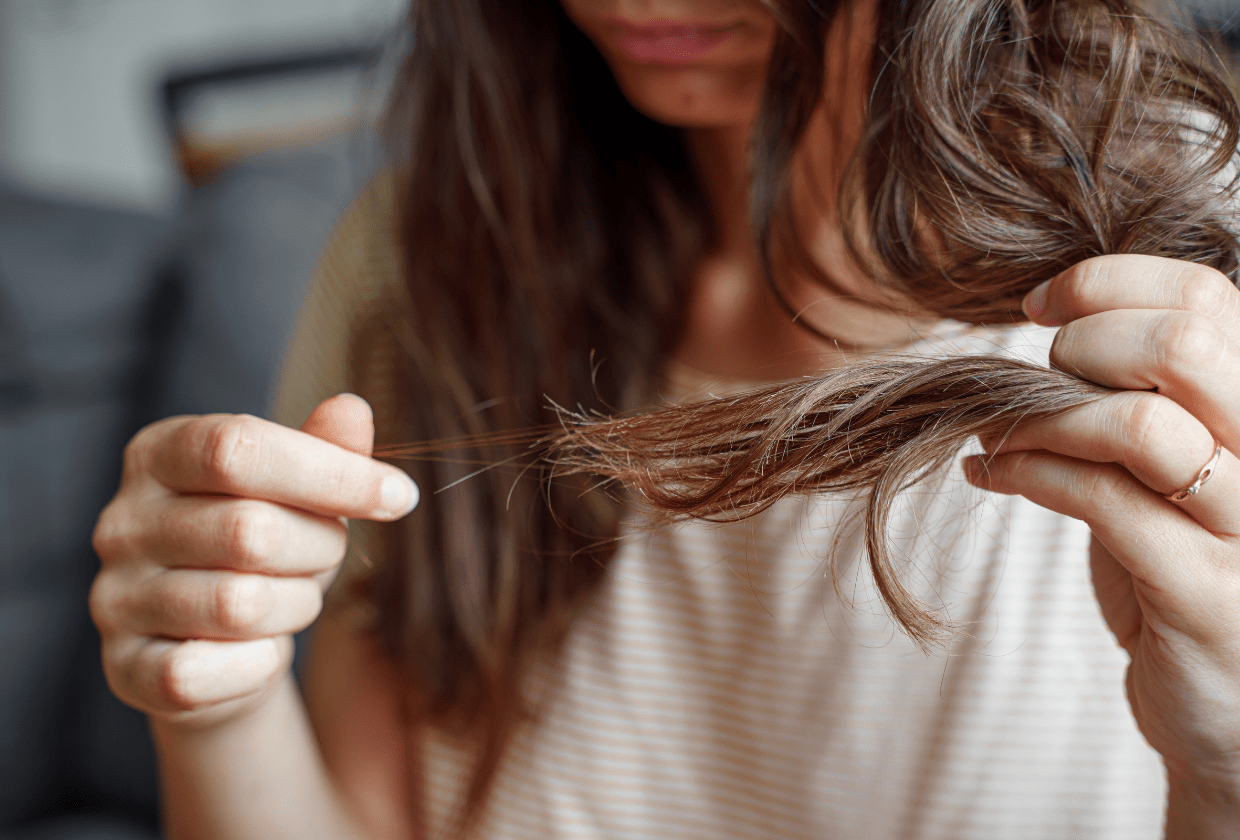 Causas da queda de cabelo