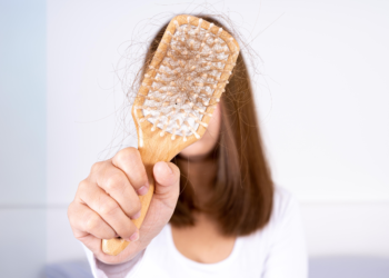 O que é bom para queda de cabelo: Descubra soluções eficazes e cuidados essenciais 11 Tratamento para queda de cabelo