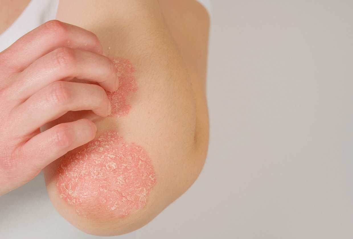 Doenças de pele mais comuns