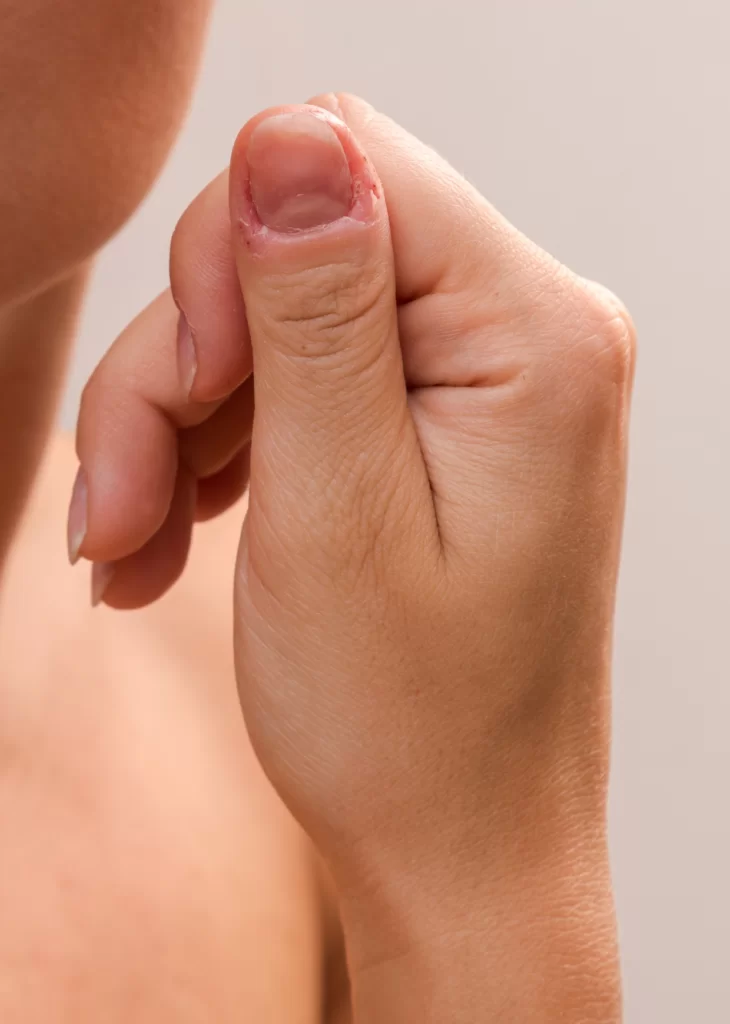 Unhas roídas: Entendendo e superando o hábito com 13 dicas 2 unhas roídas