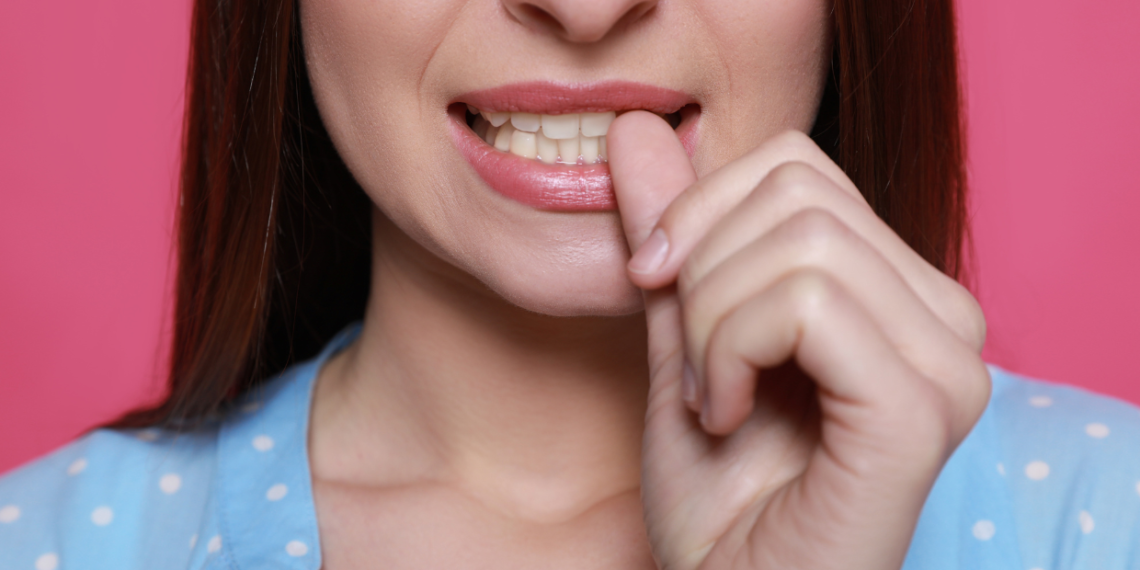 Unhas roídas: Entendendo e superando o hábito com 13 dicas 1 onicofagia