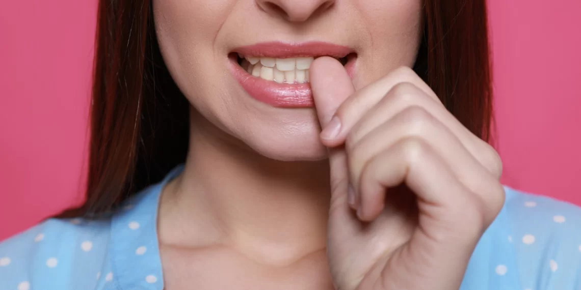 Unhas roídas: Entendendo e superando o hábito com 13 dicas 1 onicofagia