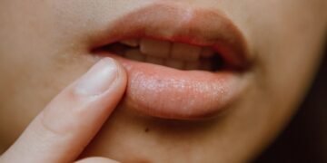 Como escolher o melhor hidratante labial para o seu tipo de lábio