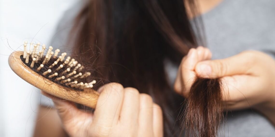 Queda de cabelo feminino: causas comuns e o que realmente pode ajudar 1 Causa da Queda de cabelo feminino